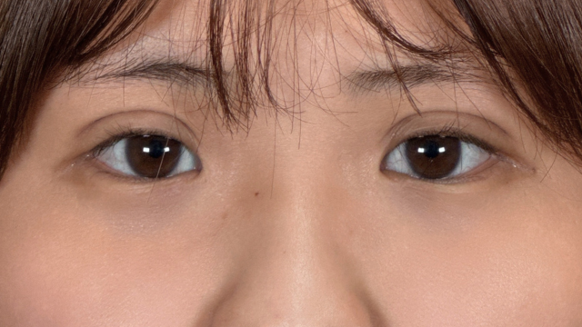 手术前的状态 其一