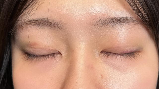 手术前的状态 其一