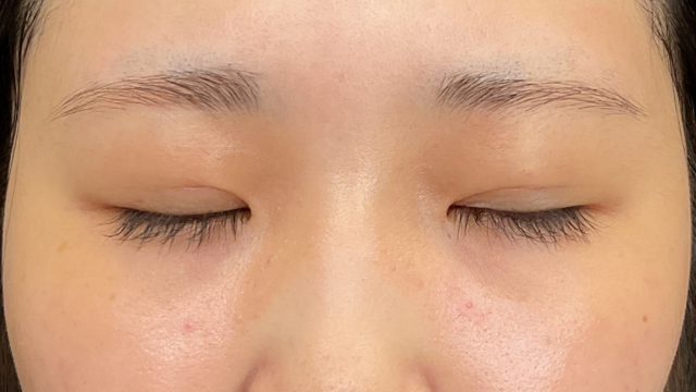 手术前的状态 其一