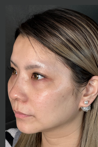 手术前的状态 其一