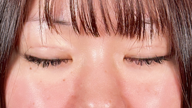 手术前的状态 其一