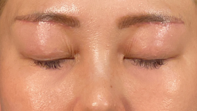 Postoperative Condition Part 1