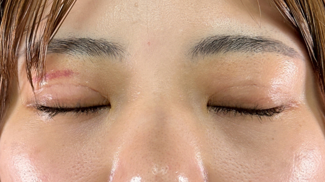 Postoperative Condition Part 1