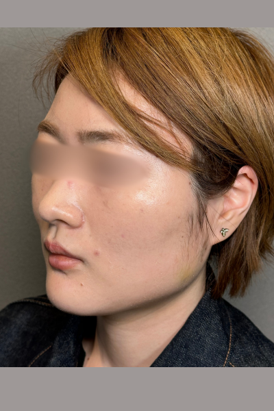 手術前の状態 その1