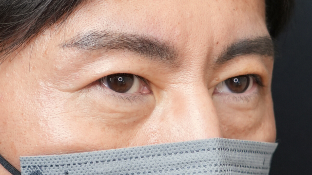 手术前的状态 其一