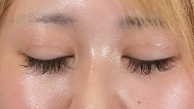 Postoperative Condition Part 1