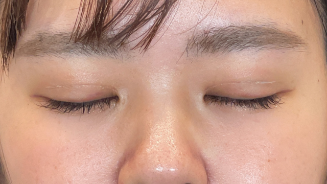 Postoperative Condition Part 1