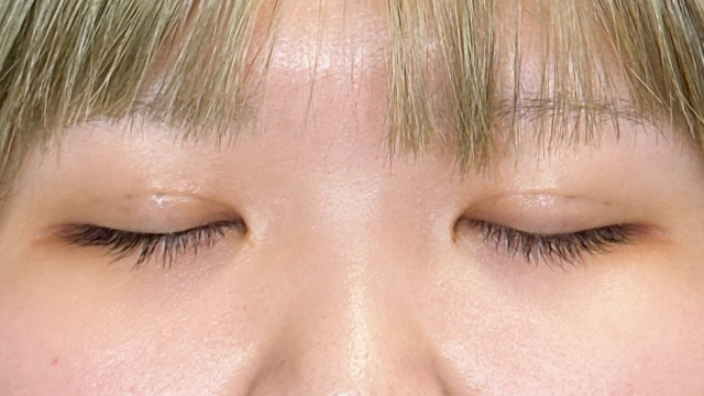 手术前的状态 其一