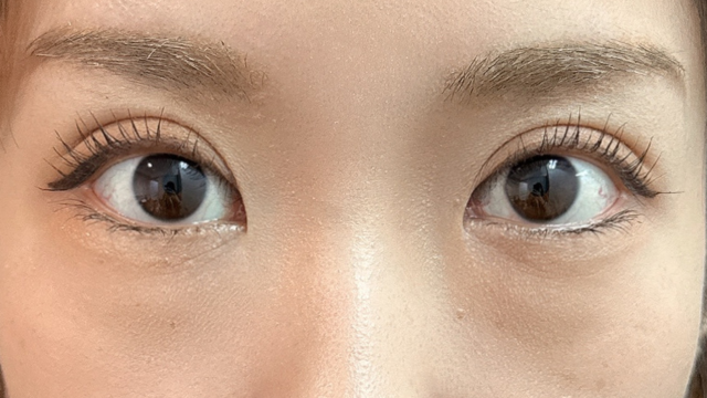 手术前的状态 其一