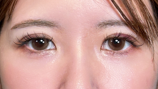 手术前的状态 其一