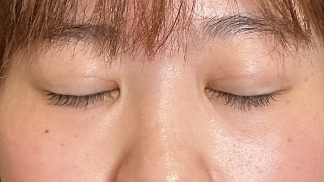 Postoperative Condition Part 1