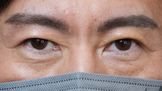 手术前的状态 其一