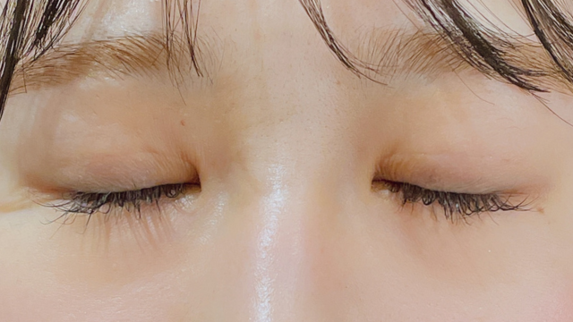 手术前的状态 其一