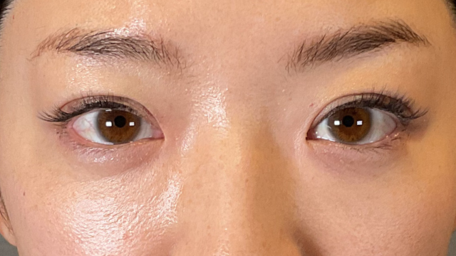 手术前的状态 其一