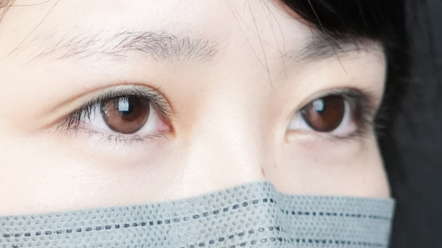 手术前的状态 其一