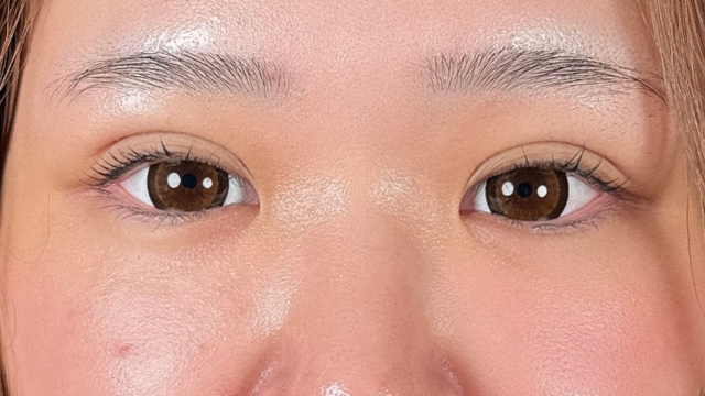 手术前的状态 其一