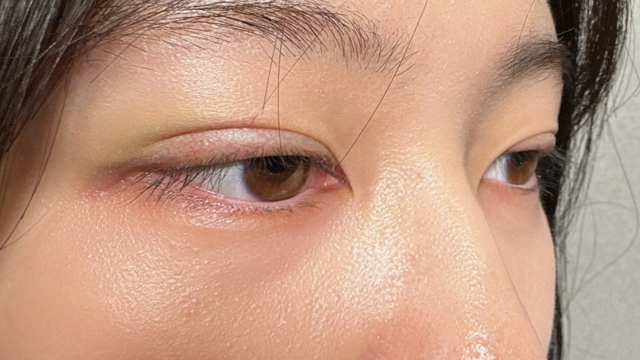 手术前的状态 其一