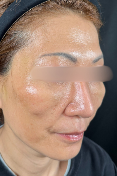 手术前的状态 其一