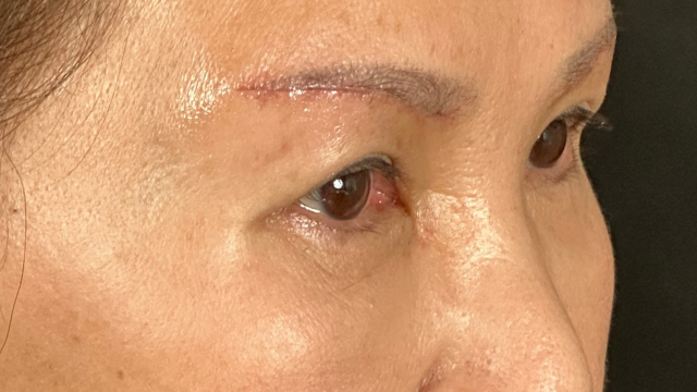 Postoperative Condition Part 1