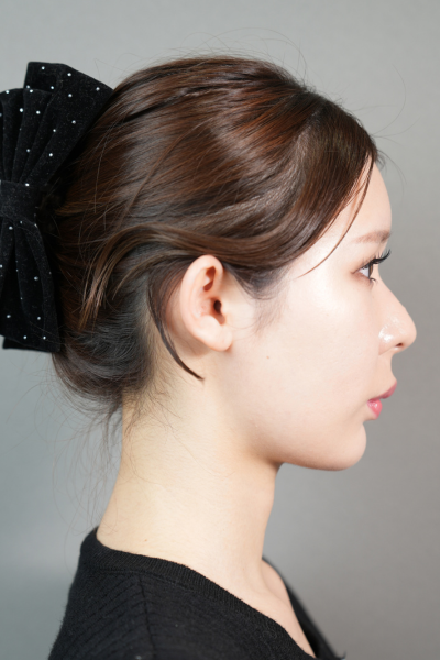 手術前の状態 その1