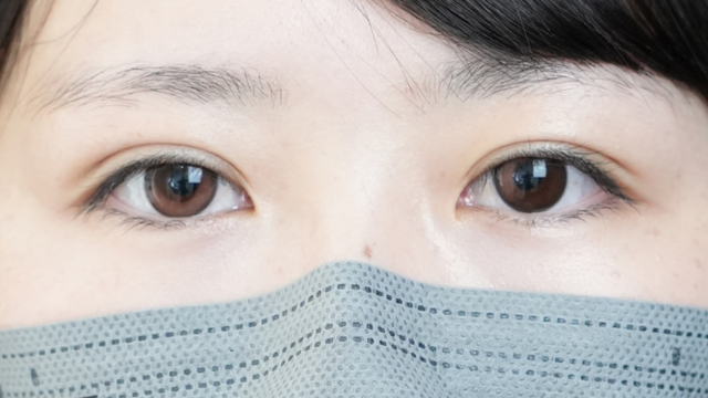 手术前的状态 其一