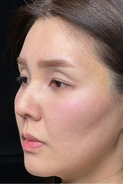 手術前の状態 その1