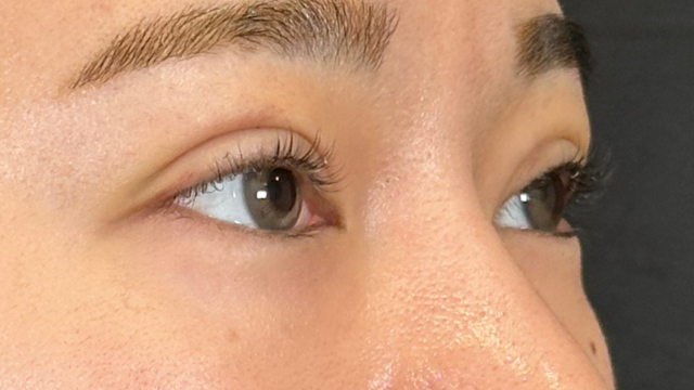 手術前の状態 その1