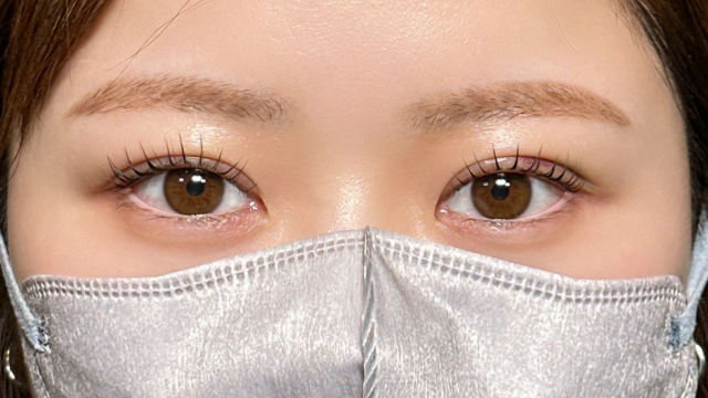 手术前的状态 其一