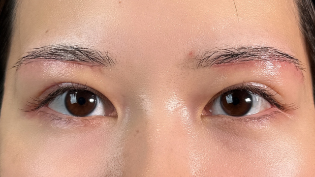 Postoperative Condition Part 1