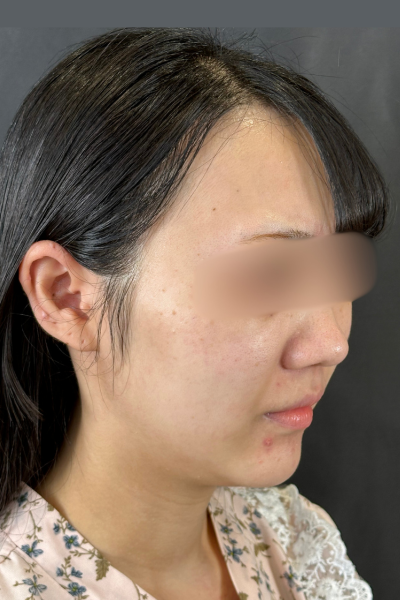 手術前の状態 その1