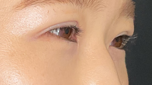 手术前的状态 其一