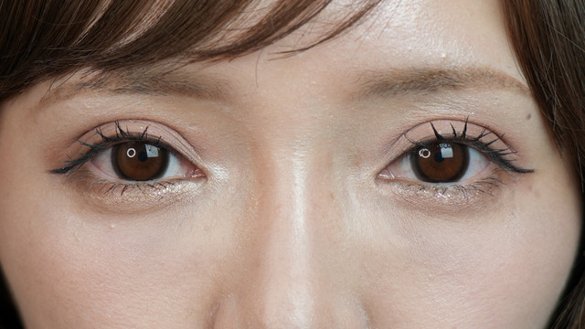 Postoperative Condition Part 1