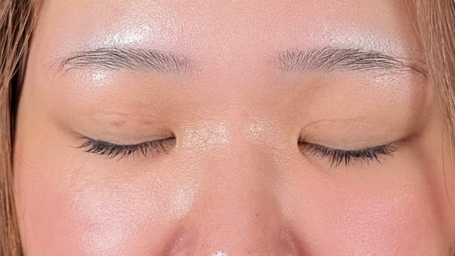 手术前的状态 其一