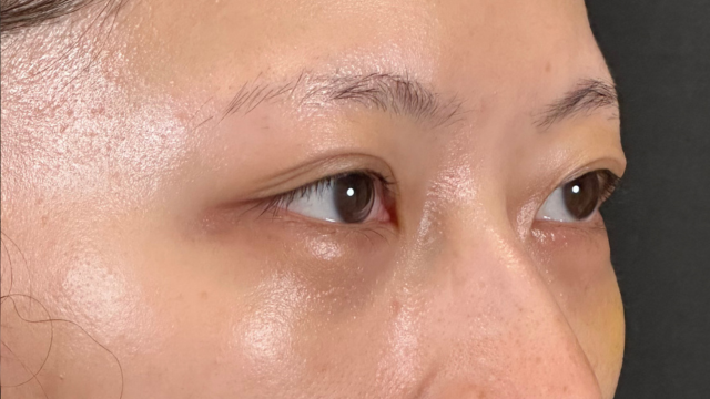 手术前的状态 其一