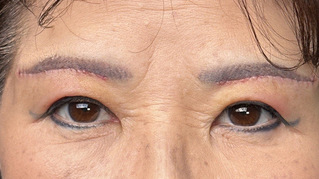 Postoperative Condition Part 1