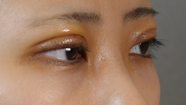 手術前の状態 その1