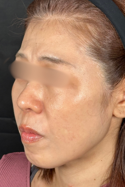 手術前の状態 その1