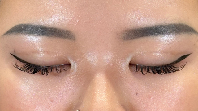 手術前の状態 その1