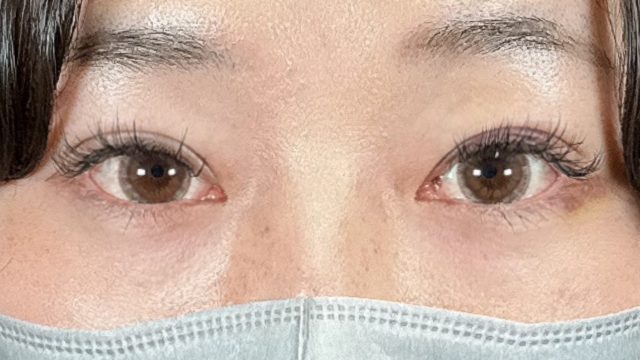 手术前的状态 其一