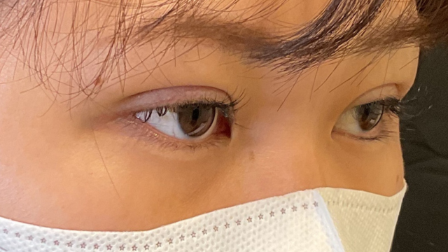 Postoperative Condition Part 1