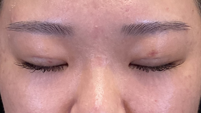 手術前の状態 その1