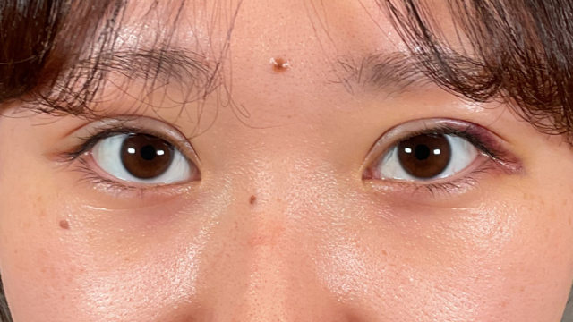 Postoperative Condition Part 1