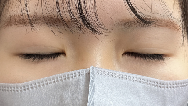 手术前的状态 其一