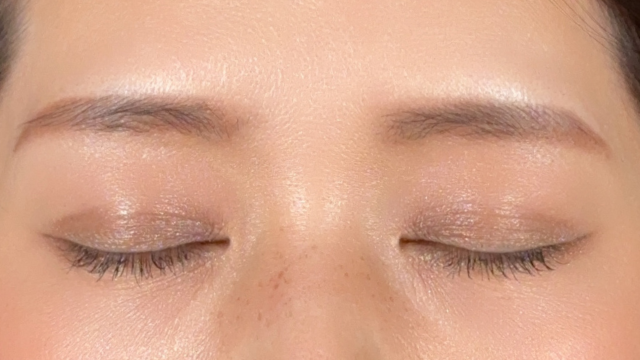 手術前の状態 その1