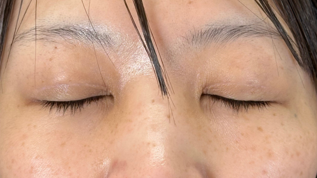 手术前的状态 其一