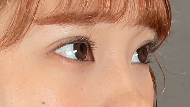 手术前的状态 其一