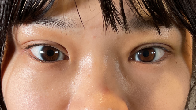 手术前的状态 其一