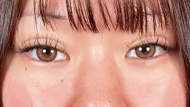 手术前的状态 其一