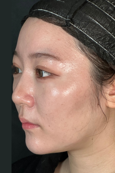 手術前の状態 その1