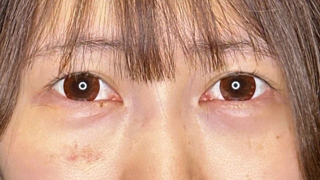 手术前的状态 其一